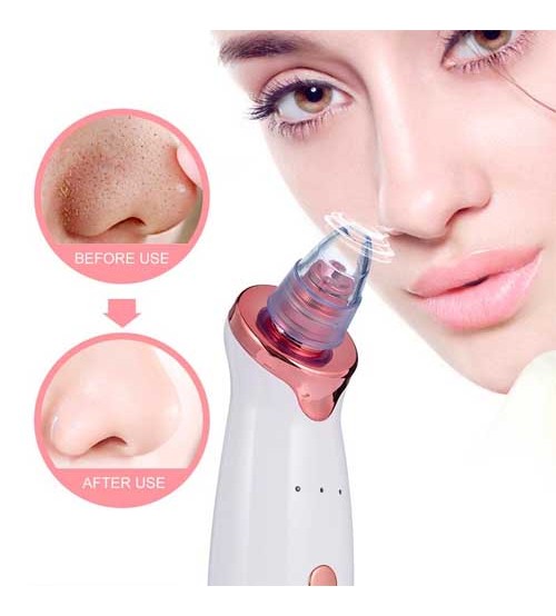 Blackhead Remover Vacuum Cleaner Black Dot Facial Pore Cleaner Pimple Skin Spot Remover